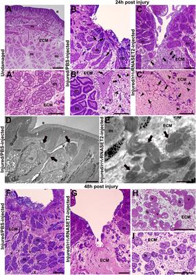 HvRNASET2 Regulate Connective Tissue and Collagen I Remodeling During Wound Healing Process